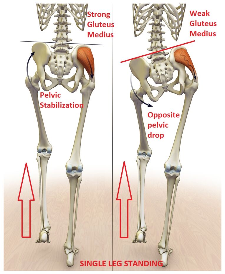 stretches for a pulled gluteus medius