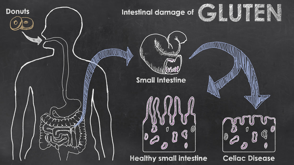 Il Glutine Fa Male O Si Può Mangiare Senza Problemi? - Project InVictus